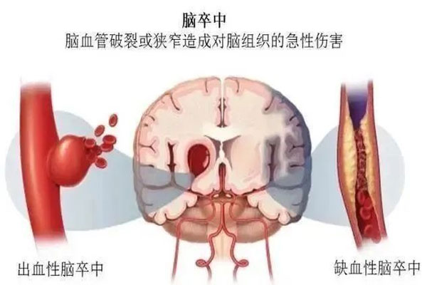 Öзç,ȱѪÐÔÖзç,³öѪÐÔÖзç Öзç,ȱѪÐÔÖзç,³öѪÐÔÖзç