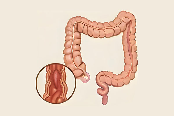 ��Ӯ���ޡ�bwin(�й���)�ٷ���վ